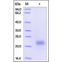The purity of rh TMED4 / ERS25 was determined by DTT-reduced (+) SDS-PAGE and staining overnight with Coomassie Blue.