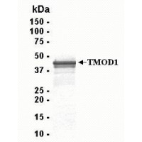 SDS PAGE: Analysis of TMOD1 Recombinant Protein. 4-20% SDS gradient gel. Coomassie blue staining.
