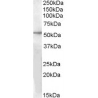 Western blot analysis of GPR142 in Human Liver Lysate (35 μg protein in RIPA buffer) with (B) and without (A) blocking with the immunizing peptide using GPR142 antibody (1 μg/mL).
