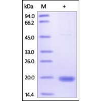 The purity of rh TXNDC12 was determined by DTT-reduced (+) SDS-PAGE and staining overnight with Coomassie Blue.