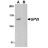Western blot analysis of GPVI in A20 lysate with GPVI antibody at 1μg/mL in either the absence or (B) the presence of blocking peptide.