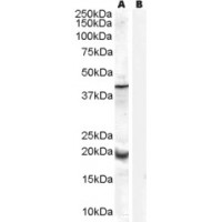 Western blot analysis of GPX7 in Human Prostate Lysate (35 μg protein in RIPA buffer) with (B) and without (A) blocking with the immunizing peptide using GPX7 antibody (0.3 μg/mL).