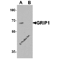 Western blot analysis of GRIP1 in HeLa cell lysate with GRIP1 antibody at μg/mL in (A) the absence and (B) the presence of blocking peptide.