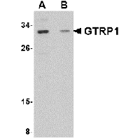 Western blot analysis of GRTP1 in SK-N-SH cell lysate with GRTP1 antibody at 1 μg/mL in the (A) absence and (B) presence of blocking peptide.