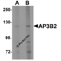 Western blot analysis of SPRYD4 in mouse kidney tissue lysate with SPRYD4 antibody at 1 μg/mL in (A) the absence and (B) the presence of blocking peptide.