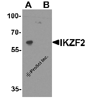 Western blot analysis of IKZF2 in EL4 cell lysate with IKZF2 antibody at 1 μg/ml in (A) the absence and (B) the presence of blocking peptide.
