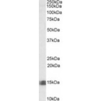 Western blot analysis of INCA in Human Kidney Lysate (35 μg protein in ripa buffer) using INCA antibody (0.5 μg/mL).