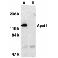 Western blot analysis of Apaf1 in human heart tissue lysate with Apaf1 antibody at 1 μg/mL dilution in the absence (A) or presence (B) of blocking peptide (2015P).