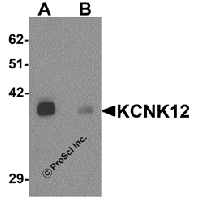 Western blot analysis of KCNK12 in rat brain tissue lysate with KCNK12 antibody at 0.5 μg/mL in (A) the absence and (B) the presence of blocking peptide.