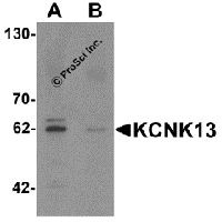 Western blot analysis of KCNK13 in rat brain tissue lysate with KCNK13 antibody at 0.5 μg/mL in (A) the absence and (B) the presence of blocking peptide.