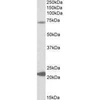Western blot analysis of KCNN2 in Human Liver Lysate (35 μg protein in ripa buffer) using KCNN2 antibody (0.3 μg/mL).