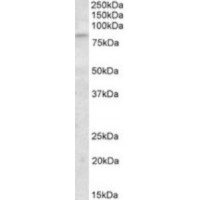 Western blot analysis of KLHL6 in 3T3 (NIH) Cell Lysate (35 μg protein in RIPA buffer) using KLHL6 antibody (1 μg/mL).