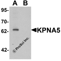 Western blot analysis of KPNA6 in EL4 cell lysate with KPNA5 antibody at 1 μg/mL in (A) the absence and (B) the presence of blocking peptide.