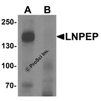 Western blot analysis of LNPEP in human lung tissue lysate with LNPEP antibody at 1 μg/mL in (A) the absence and (B) the presence of blocking peptide.