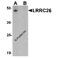 Western blot analysis of LRRC26 in human prostate tissue lysate with LRRC26 antibody at 0.5 μg/ml in (A) the absence and (B) the presence of blocking peptide.
