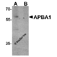 Western blot analysis of APBA1 in rat brain tissue lysate with APBA1 antibody at 0.5 μg/ml in (A) the absence and (B) the presence of blocking peptide.
