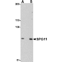 Western blot analysis of MATN4 in rat brain tissue lysate with MATN4 antibody at 1 μg/mL in (A) the absence and (B) the presence of blocking peptide.