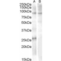 Western blot analysis of APOBEC2 in Human Heart Lysate (35 μg protein in RIPA buffer) with (B) and without (A) blocking with the immunizing peptide. Primary incubation was 1 hour. using APOBEC2 antibody (1 μg/mL).