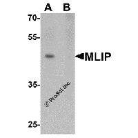 Western blot analysis of MLIP in 293 cell lysate with MLIP antibody at 1 μg/mL in (A) the absence and (B) the presence of blocking peptide.