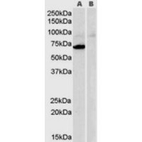 Western blot analysis of Monoamine Oxidase A in Human Heart Lysate (35 μg protein in RIPA buffer) with (B) and without (A) blocking with the immunizing peptide using Monoamine Oxidase A antibody (0.3 μg/mL).