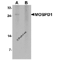 Western blot analysis of MOSPD1 in human brain tissue lysate with MOSPD1 antibody at 1 μg/mL in (A) the absence and (B) the presence of blocking peptide.