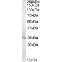 Western blot analysis of MTHFS in Human Liver Lysate (35 μg protein in RIPA buffer) with (B) and without (A) blocking with the immunizing peptide using MTHFS antibody (0.5 μg/mL).