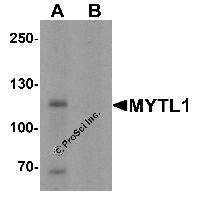 Western blot analysis of MYT1L in mouse brain tissue lysate with MYT1L antibody at 1 μg/mL in (A) the absence and (B) the presence of blocking peptide.