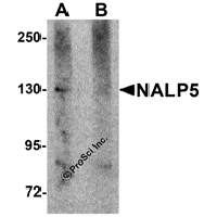 Western blot analysis of NALP5 in mouse brain tissue lysate with NALP5 antibody at 1 μg/mL in (A) the absence and (B) the presence of blocking peptide.