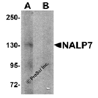 Western blot analysis of NALP7 in human brain tissue lysate with NALP7 antibody at 1 μg/mL in (A) the absence and (B) the presence of blocking peptide.