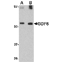 Western blot analysis of Nanos1 in SK-N-SH cell lysate with Nanos1 antibody at 1 μg/mL in (A) the presence and (B) the absence of blocking peptide.