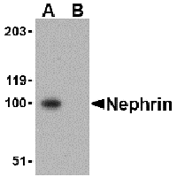 Western blot analysis of Nephrin in mouse kidney tissue lysate with Nephrin antibody at 1 μg/mL in the (A) absence and (B) presence of blocking peptide (2265P).