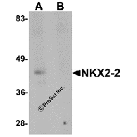 Western blot analysis of NKX2-2 in rat kidney tissue lysate with NKX2-2 antibody at 1 μg/mL in (A) the absence and (B) the presence of blocking peptide.