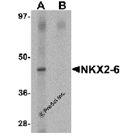 Western blot analysis of NKX2-6 in mouse spleen tissue lysate with NKX2-6 antibody at 1 μg/mL in (A) the absence and (B) the presence of blocking peptide.