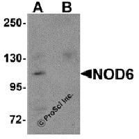 Western blot analysis of NOD6 in EL4 cell lysate with NOD6 antibody at 1 μg/mL in the (A) absence and (B) presence of blocking peptide.