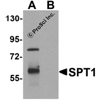 Western blot analysis of TEKT5 in 3T3 cell lysate with TEKT5 antibody at 0.5 μg/mL in (A) the absence and (B) the presence of blocking peptide.