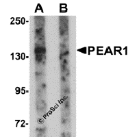 Western blot analysis of PEAR1 in rat kidney tissue lysate with PEAR1 antibody at 1 μg/mL in (A) the absence and (B) the presence of blocking peptide.