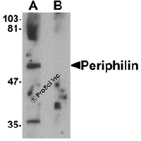 Western blot analysis of JMJD3 in K562 cell lysate with JMJD3 antibody at 0.5 μg/mL in (A) the absence and (B) the presence of blocking peptide.