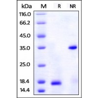 Human ALCAM, His Tag on SDS-PAGE under reducing (R) and no-reducing (NR) conditions. The gel was stained overnight with Coomassie Blue. The purity of the protein is greater than 95%.