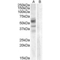 Western blot analysis of Arylsulfatase D in A459 Lysate (35 μg protein in RIPA buffer) with (B) and without (A) blocking with the immunizing peptide using Arylsulfatase D antibody (0.3 μg/mL).