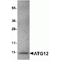 SDS-PAGE analysis of recombinant ATG12 on Coomassie Blue-stained 4 - 12% SDS-PAGE gel.