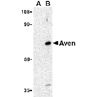 Western blot analysis of PID expression in HeLa whole cell lysates in the absence (A) or presence (B) of blocking peptide with PID antibody at 1 μg /ml (2443P).