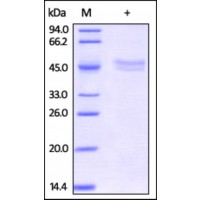 The purity of rh Carbonic Anhydrase XIV (CA14) was determined by DTT-reduced (+) SDS-PAGE and staining overnight with Coomassie Blue.