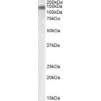 Western blot analysis of PLA2R1 in Human Ileum Lysate (35 μg protein in ripa buffer) using PLA2R1 antibody (1 μg/mL).