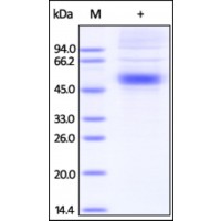 The purity of rh IL5RA /CD125 was determined by DTT-reduced (+) SDS-PAGE and staining overnight with Coomassie Blue.