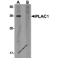 Western blot analysis of PLAC1 in human placenta tissue lysate with PLAC1 antibody at 1 μg/mL in (A) the absence and (B) the presence of blocking peptide.