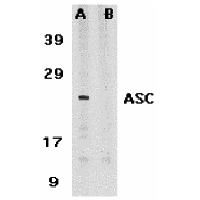 Western blot analysis of ASC in HL60 whole cell lysate in the absence (A) or presence (B) of blocking peptide (2287P) with ASC antibody at 1 μg /ml.