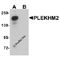 Western blot analysis of PLEKHM2 in rat brain tissue lysate with PLEKHM2 antibody at 0.5 μg/mL in (A) the absence and (B) the presence of blocking peptide.