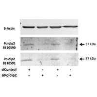 Western blot analysis of POLDIP2 in Rat Rat Vascular Smooth Muscle Cell Lysate (35 μg protein in RIPA buffer) using POLDIP2 antibody (0.5 μg/mL).