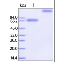 The purity of rh IL21R / CD360 Fc Chimera was determined by DTT-reduced (+) and non-reduced (-) SDS-PAGE and staining overnight with Coomassie Blue.