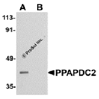 Western blot analysis of PPAPDC2 in Raji cell lysate with PPAPDC2 antibody at 1 μg/mL in (A) the absence and (B) the presence of blocking peptide.